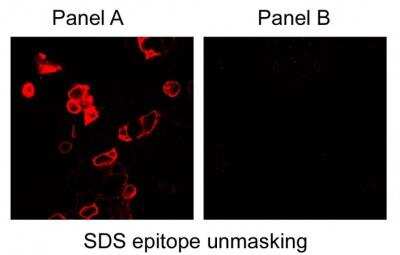 Immunocytochemistry/Immunofluorescence Staining of Carbonic Anhydrase IX/CA9 in Transfected and Mock-Transfected HEK293 Cells